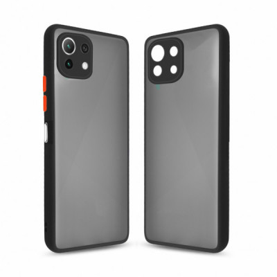 Чохол до мобільного телефона MakeFuture Xiaomi Mi 11 Lite 5G NE Frame (Matte PC+TPU) Black (MCMF-XM11L5GNEBK)